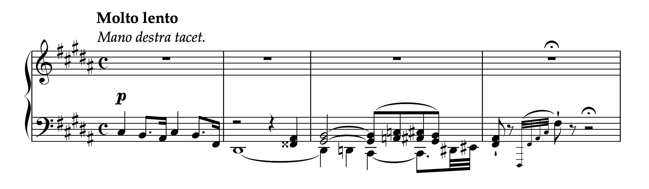 デーラー「12の演奏会用練習曲 Op.30 より 第7番」1-4小節